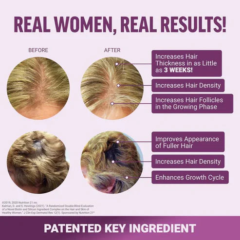 VitalHeal® Hair Growth Accelerator Gummies